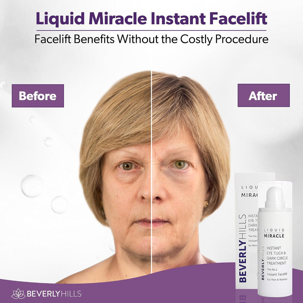 Beverly Hills Instant Facelift Anti Aging Eye Serum Treatment For Dark Circles, Puffy Eyes, Wrinkles, Under Eye Bags, Fine Lines, And Crows Feet | 30Ml (120 Days Supply)