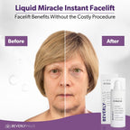 Beverly Hills Instant Facelift Anti Aging Eye Serum Treatment For Dark Circles, Puffy Eyes, Wrinkles, Under Eye Bags, Fine Lines, And Crows Feet | 30Ml (120 Days Supply)