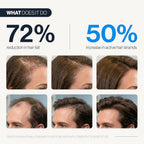 Be Bodywise Hair Growth Serum Roll On - 5% Saw Palmetto, 3% Rosemary Oil for Hair Growth, 3% Fenugreek,1% Caffeine Herbasome | Serum for Hair Loss & Hair Regrowth For Men & Women 25ml/0.84 fl oz