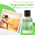 Best Ingrown Hair Treatment - Razor Bump & Bikini Line Salicylic Acid Gel - Tea Tree After Shave Bump Remover for Women - lavoSkin