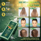 Rosemary & Batana Oil Hair Growth Shampoo: Hair Loss Shampoo For Men And Women With Biotin, Sulfate & Fragrance-Free Thickening