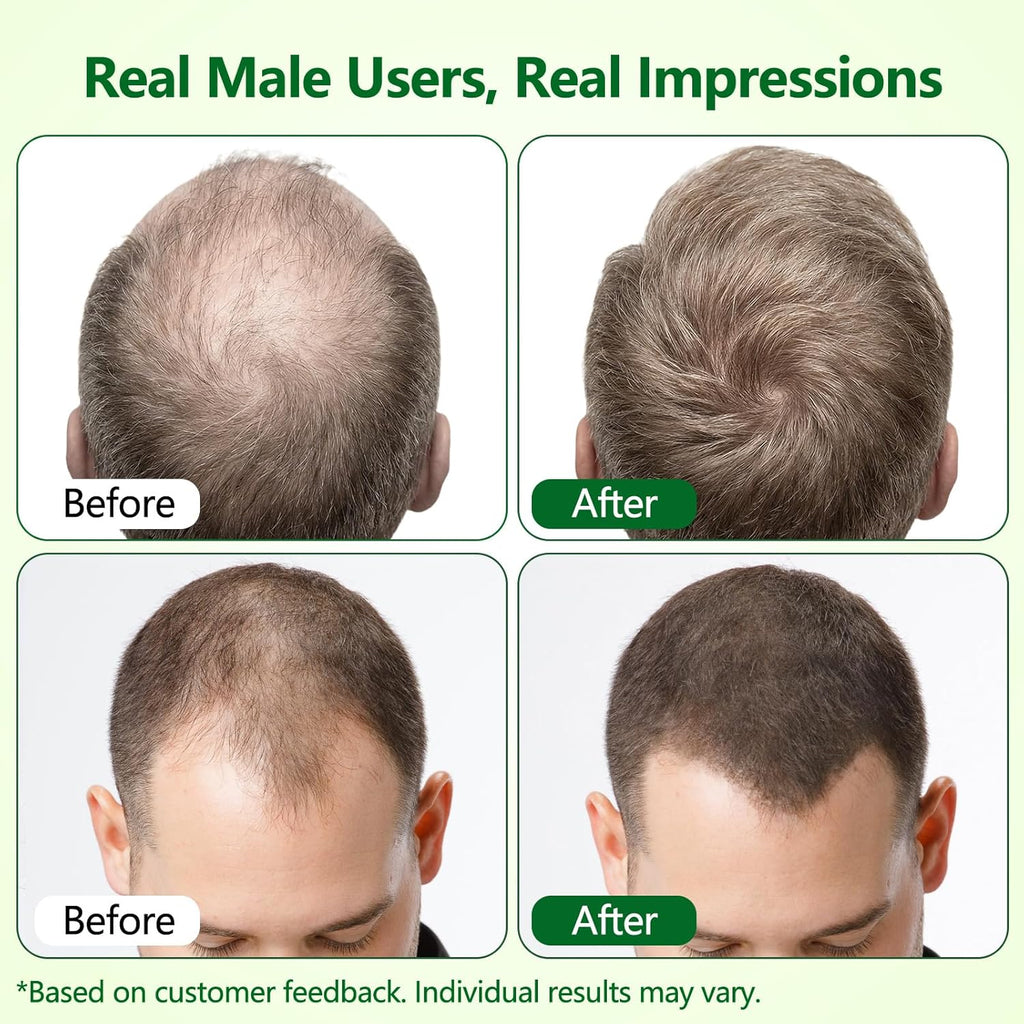 Hair Growth Serum Roll-On, Reduces Hair Shedding & Strengthens Roots, Helps Support Thicker, Fuller Hair, 3% Rosemary, 2% Ginger, 1.5% Pea Extract, 0.85 Fl Oz (Pack of 2)