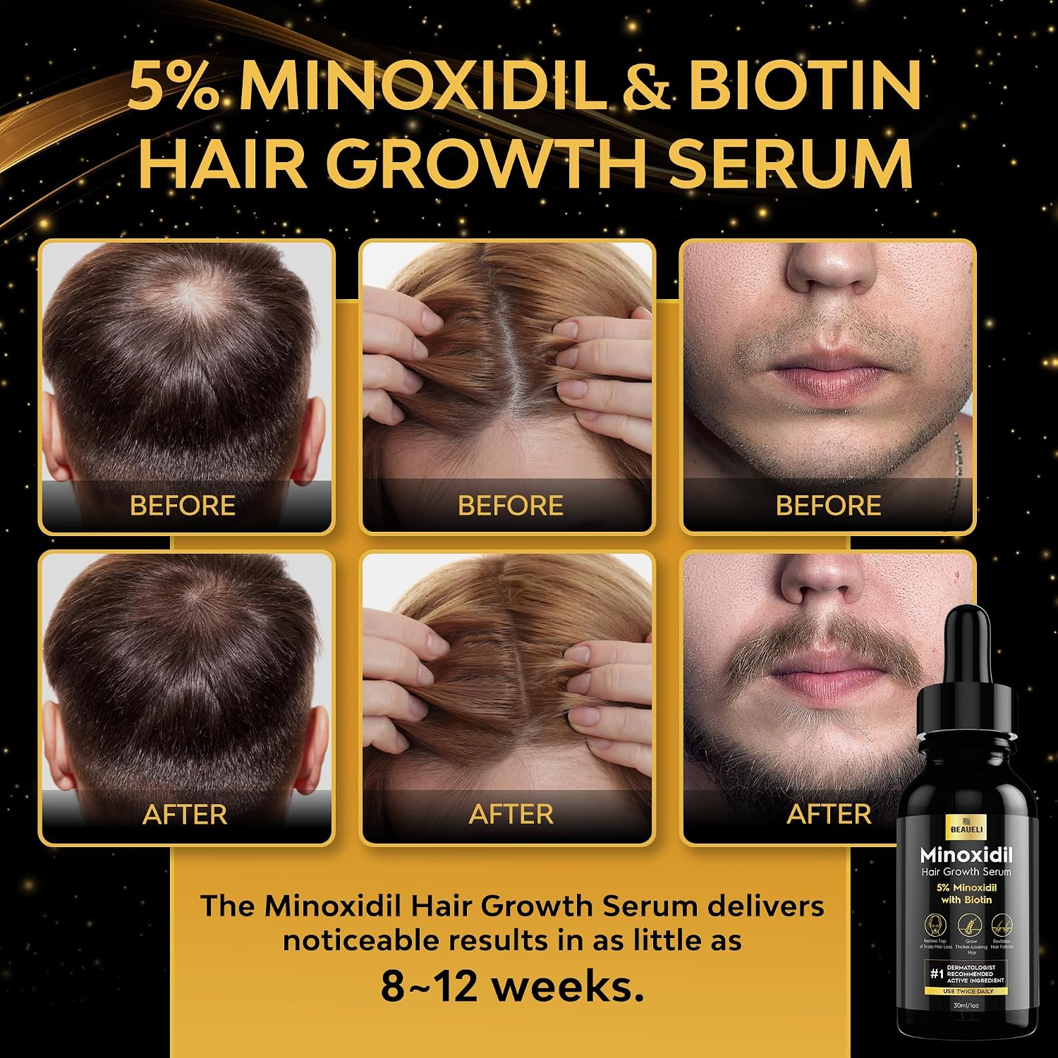 Beaueli 5% Minoxidil For Men & Women Hair Growth, Beard Growth, Hair Loss Treatment, Unisex Adult 1Oz