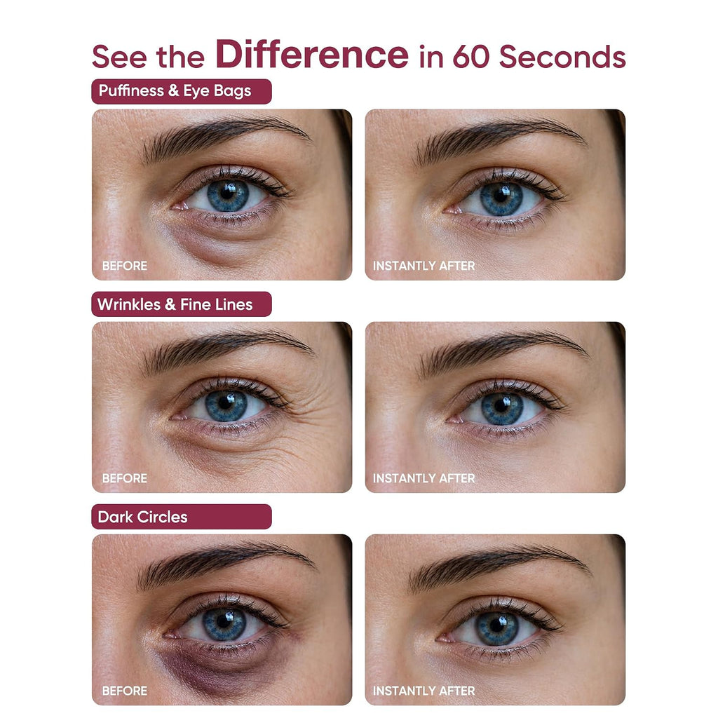 Zvye Instant Eye & Face Lift Cream: Ultimate Firming & Tightener Treatment – Reduces Under Eye Bags | Puffiness | Dark Circles | Wrinkles In 60 Seconds – For Women & Men –For All Skin Types