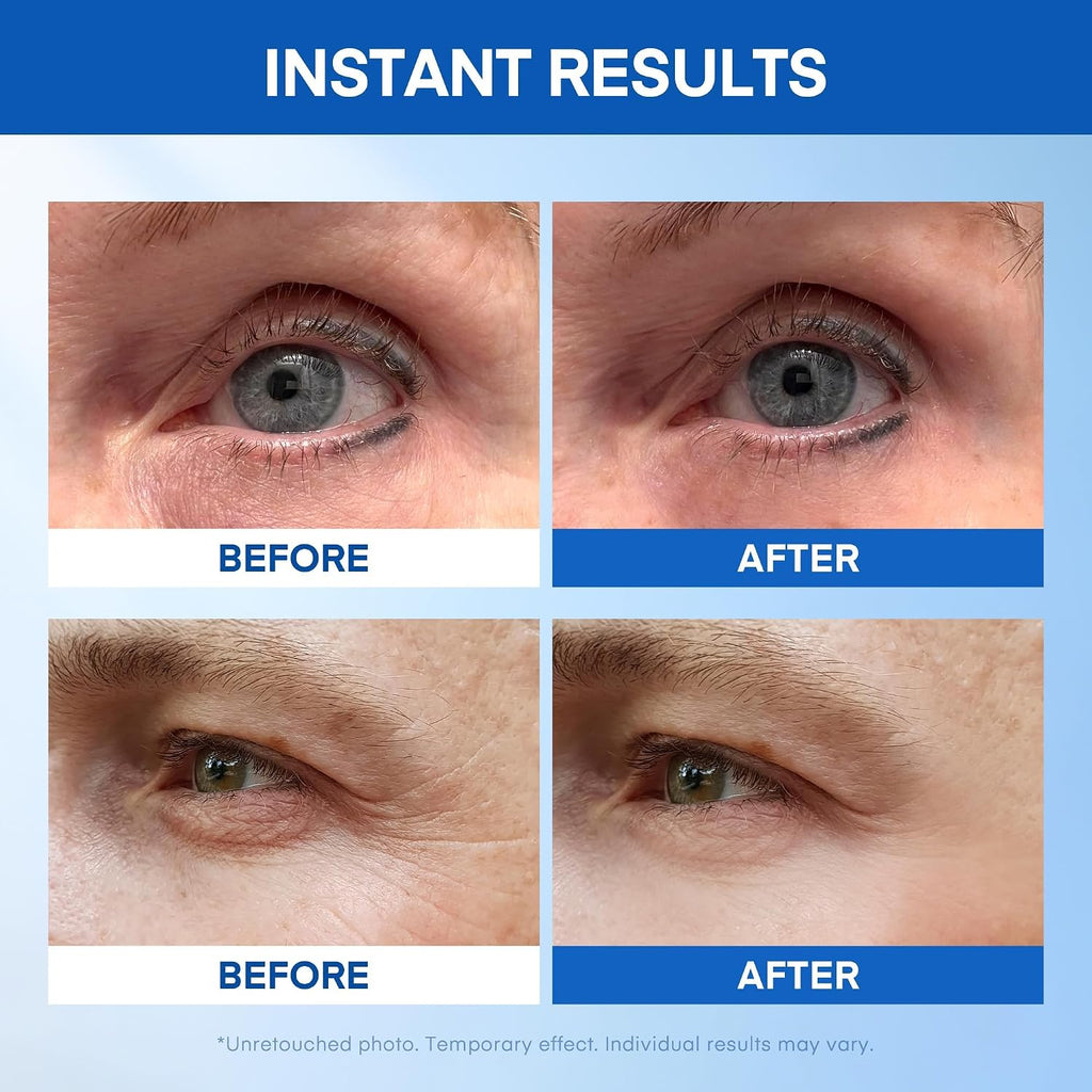 Instant Under Eye Lift Serum: Reduces Eye Bags, Wrinkles, Puffy Eyes, Dark Circles & Crow’S Feet In Minutes - Advanced Firming Polysaccharide Formula For Mature Skin - 20 Resealable Tubes