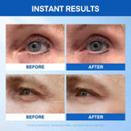 Instant Under Eye Lift Serum: Reduces Eye Bags, Wrinkles, Puffy Eyes, Dark Circles & Crow’S Feet In Minutes - Advanced Firming Polysaccharide Formula For Mature Skin - 20 Resealable Tubes