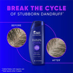Head & Shoulders Anti-Dandruff Shampoo with 1% Selenium Sulfide, Clinical Strength Advanced Oil Control Twin Pack, Seborrheic Dermatitis Relief, Oily Scalp, 13.5 fl oz Each