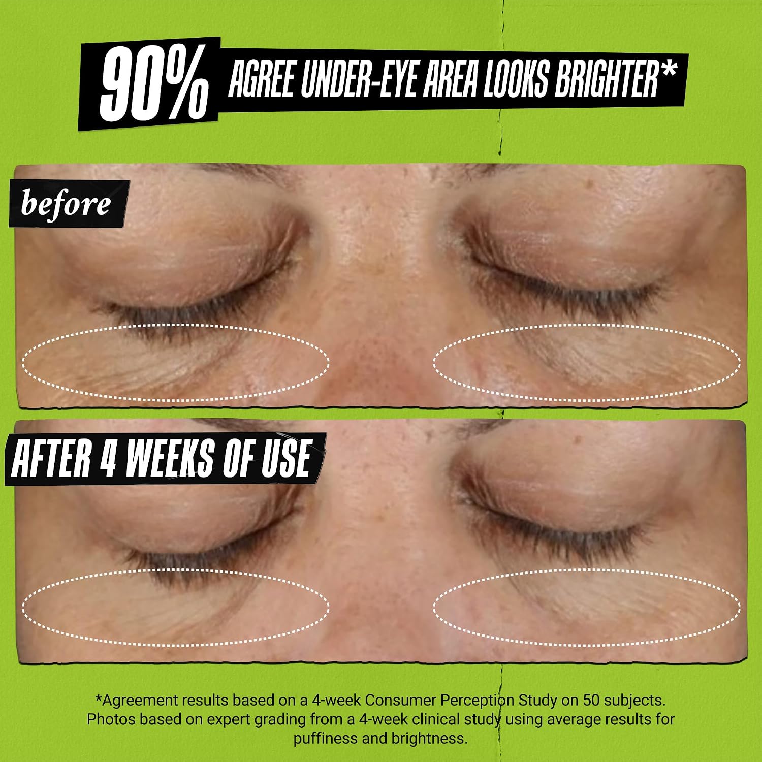 Kiehl'S Avocado Eye Treatment, Under Eye Cream For Puffiness And Dark Circles, With Caffeine To Correct Bags, 99% Naturally Derived Non-Toxic Formula