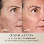 No7 Future Renew Damage Reversal Anti Aging Serum For Face - Face Serum For Women With Peptides To Support Skin Repair - Helps Reduce Fine Lines, Wrinkles, Dryness & Uneven Tone (0.84 Fl Oz)