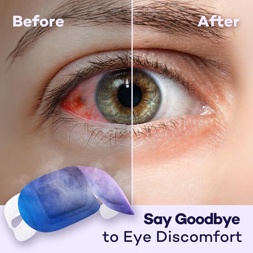 Steam Eye Masks For Dry Eyes, 45 Min+ Heated Eye Mask, Disposable Self Heating Warm Compress, Fast Relief For Eye Strain & Stye, Long Lasting Sleep & Travel Essentials, Unscented (20 Pack)