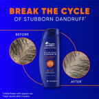 Head & Shoulders Anti-Dandruff Shampoo With 1% Selenium Sulfide, Clinical Strength Dry Scalp Rescue Shampoo Twin Pack, Seborrheic Dermatitis Relief, Dry Scalp 13.5 Fl Oz Each