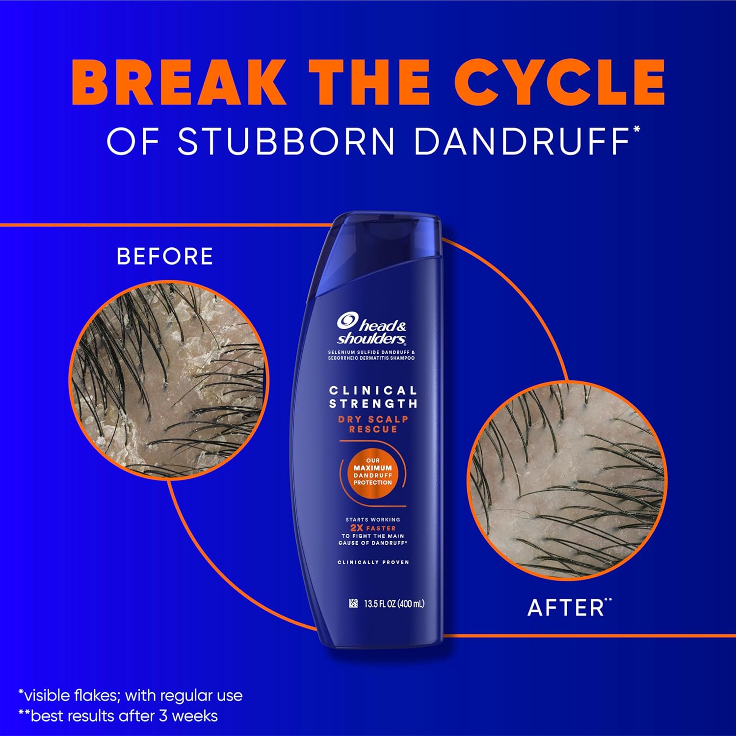 Head & Shoulders Anti-Dandruff Shampoo with 1% Selenium Sulfide, Clinical Strength Dry Scalp Rescue Shampoo Twin Pack, Seborrheic Dermatitis Relief, Dry Scalp 13.5 fl oz Each