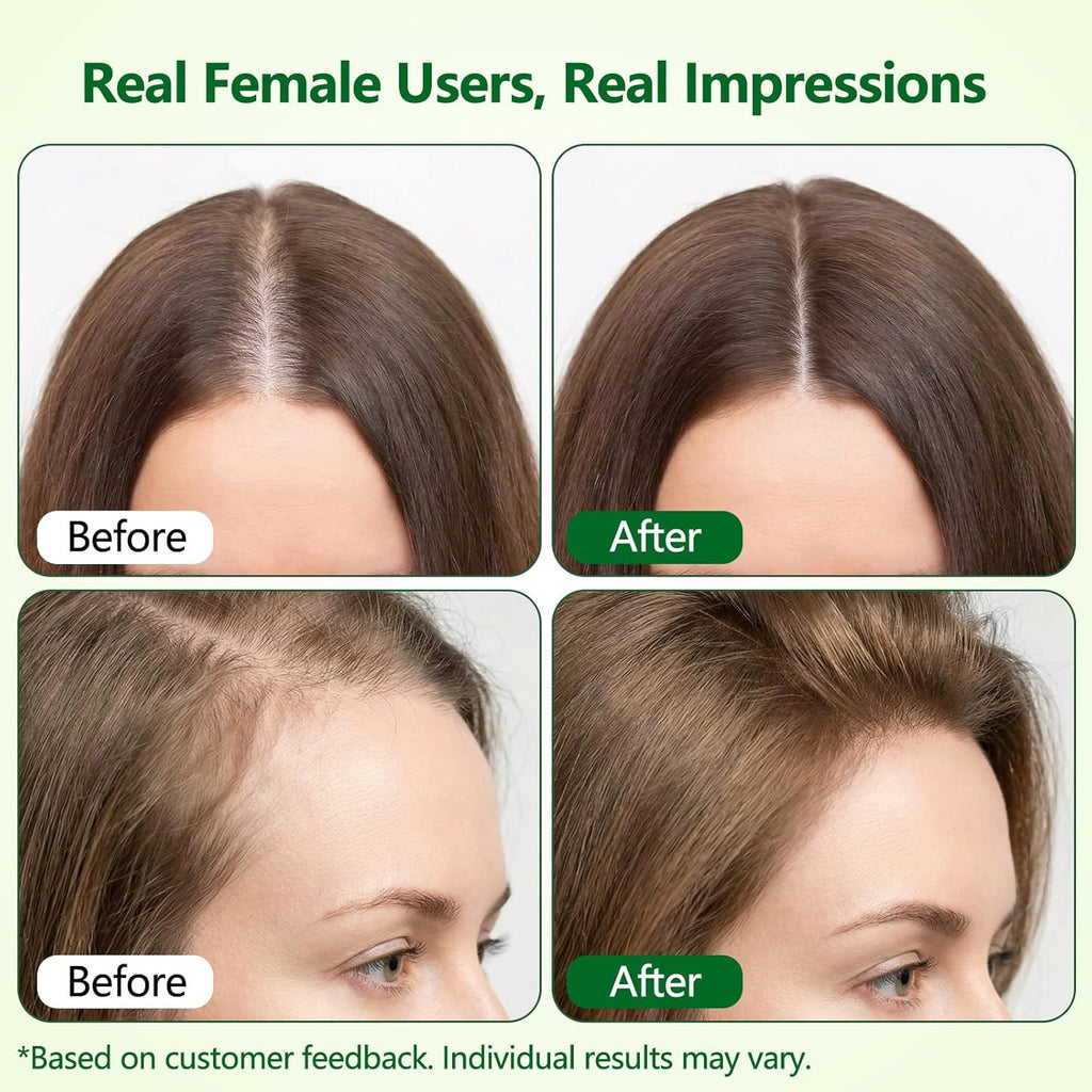 Hair Growth Serum Roll-On, Reduces Hair Shedding & Strengthens Roots, Helps Support Thicker, Fuller Hair, 3% Rosemary, 2% Ginger, 1.5% Pea Extract, 0.85 Fl Oz (Pack of 2)