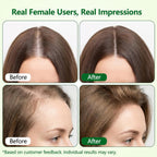 Hair Growth Serum Roll-On, Reduces Hair Shedding & Strengthens Roots, Helps Support Thicker, Fuller Hair, 3% Rosemary, 2% Ginger, 1.5% Pea Extract, 0.85 Fl Oz (Pack of 2)