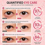 Pdrn Collagen Gel Under Eye Patches For Puffy Eyes And Dark Circles | 60 Count Hydrogel Eye Masks Korean Skincare With Niacinamide For Fine Lines & Smile Lines Under Eye Treatment For Women