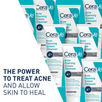 Cerave Acne Foaming Cream Cleanser, 4% Benzoyl Peroxide Face Wash With Hyaluronic Acid, Niacinamide & Ceramides, Gentle Daily Acne Treatment For Face