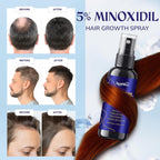 5% Minoxidil Hair Growth for Men and Women: 3-Pack RootStim Extra Strength Minoxidil Beard Regrowth Treatment with Rosemary for Thinning Hair Regrowth and Fuller Hair 180 ML