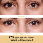 Peter Thomas Roth | 24K Gold Firming Hydra-Gel Eye Patches | Gold-Infused Eye Mask Patches For Fine Lines, Crow'S Feet And Dark Circles