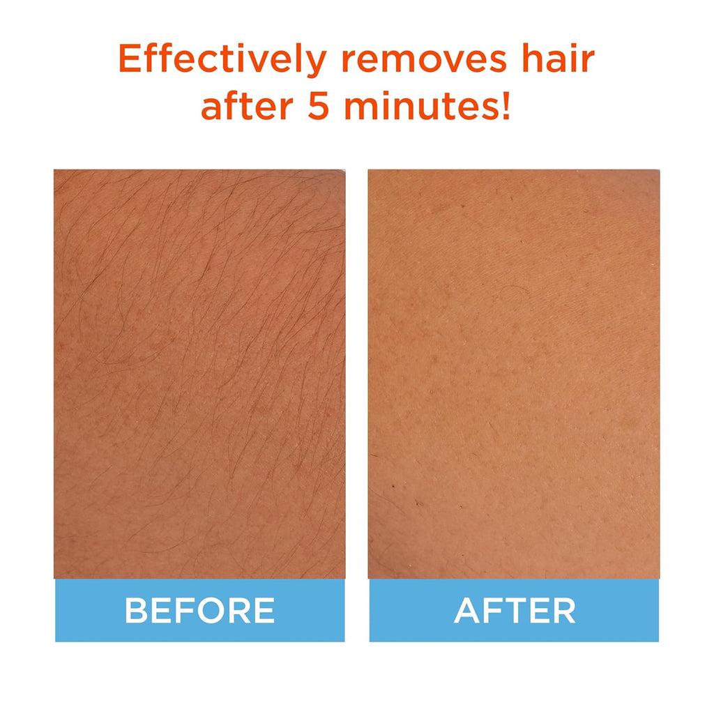 Sally Hansen Hair Remover for Face | Cream Depilatory + Aftercare Lotion | Sweet Almond & Shea Butter Infused