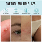 Base Labs Ingrown Hair Tweezers Set – 2 Pack Precision Tweezers for Ingrown Hair Removal, Curved & Pointed Tip Stainless Steel Tweezers with Protective Case for Razor Bumps, Splinters & Facial Hair