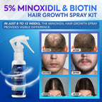 5% Minoxidil Hair Growth For Men And Women: Extra Strength Minoxidil And Biotin Beard Regrowth (2 Fl Oz, Spray 3Pcs)
