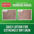 O’Keeffe’S Hardworking Body Lotion, Deep Hydration For Extremely Dry & Cracked Skin, 12 Oz Pump (1 Pack), Fragrance-Free & Hypoallergenic, Non-Greasy Fast-Absorbing Formula