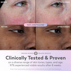 Olay Super Serum - Glow Serum For Face - Activated Niacinamide, Vitamin C & E, Collagen Peptide, Aha - 5-In-1 Benefits - Brightens, Hydrates, Smooths, Firms, Evens Tone, Proactive Anti-Aging, 1.0 Oz