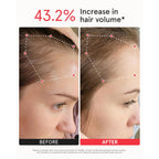 iRestore Professional Laser Red Light Therapy for Hair Growth System - FDA Cleared Hair Loss, Hair Thinning & Alopecia Treatment for Men & Women - 282 Lasers & LEDs