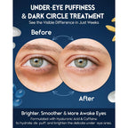 Under Eye Cream For Puffiness And Bags Under Eyes - Eye Bags Treatment For Men & Women - Anti Wrinkle Cream For Dark Circles, Baggy Eyes Treatment For Women With Retinol, Hyaluronic Acid & Caffeine