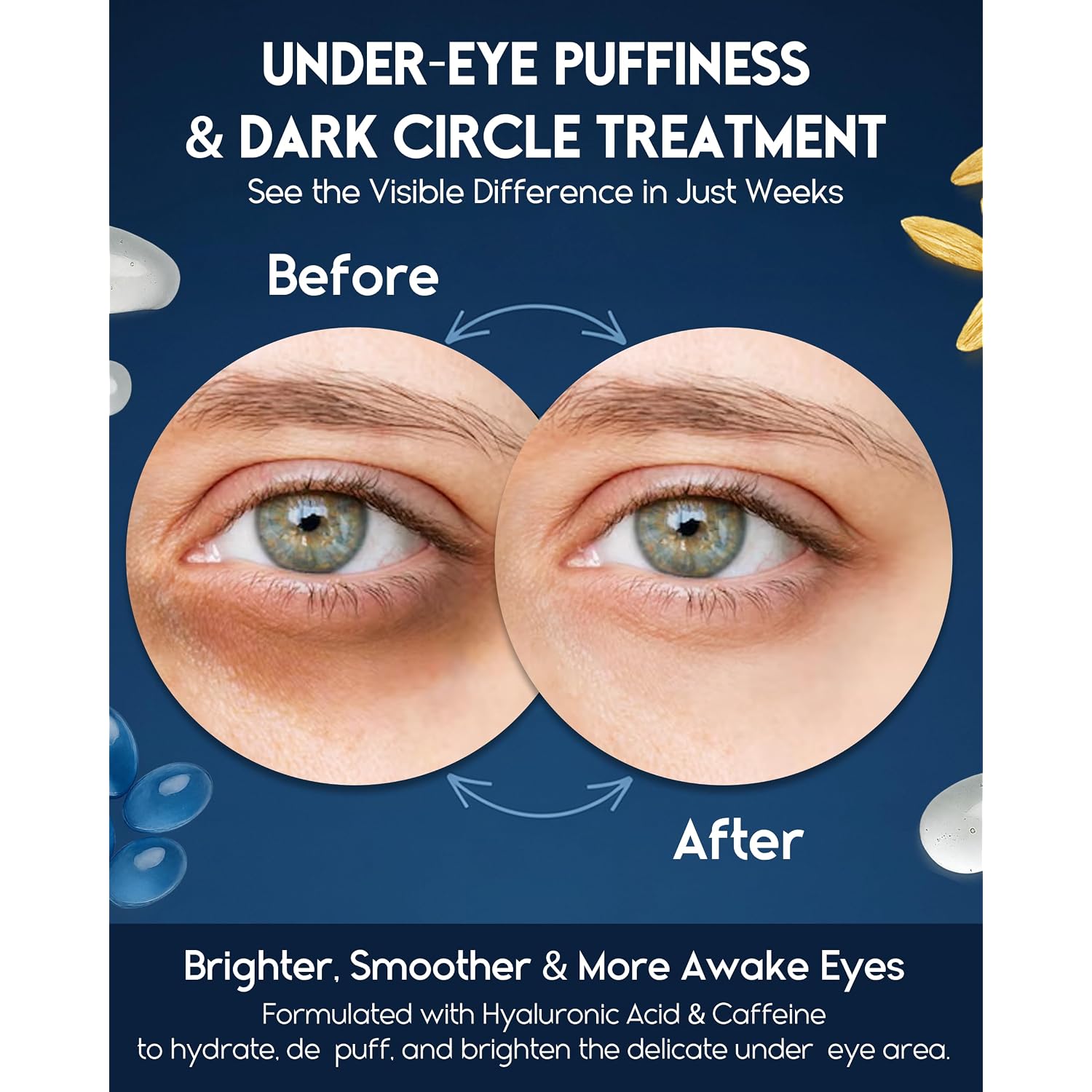 Under Eye Cream For Puffiness And Bags Under Eyes - Eye Bags Treatment For Men & Women - Anti Wrinkle Cream For Dark Circles, Baggy Eyes Treatment For Women With Retinol, Hyaluronic Acid & Caffeine