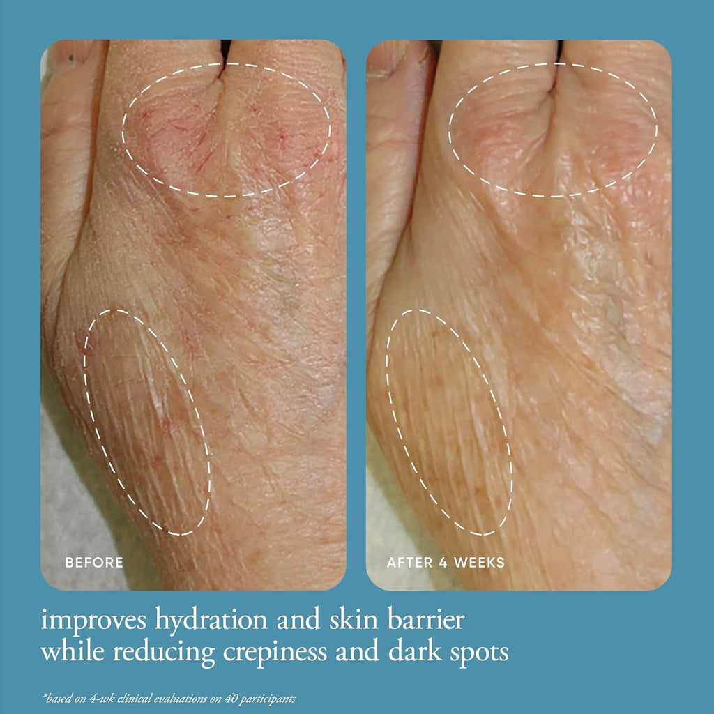 philosophy in good hands multi-restorative hand cream - with vitamin C & niacinamide - plumps & smoothes crepey skin - reduces the appearance of dark spots - transfer-proof & non-greasy formula