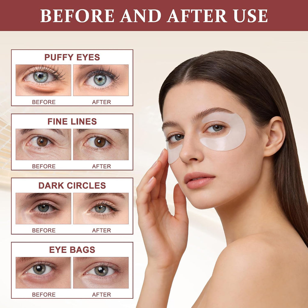 Ycz Eye Patches For Puffy Eyes And Dark Circles, Full Coverage, 60 Pcs
