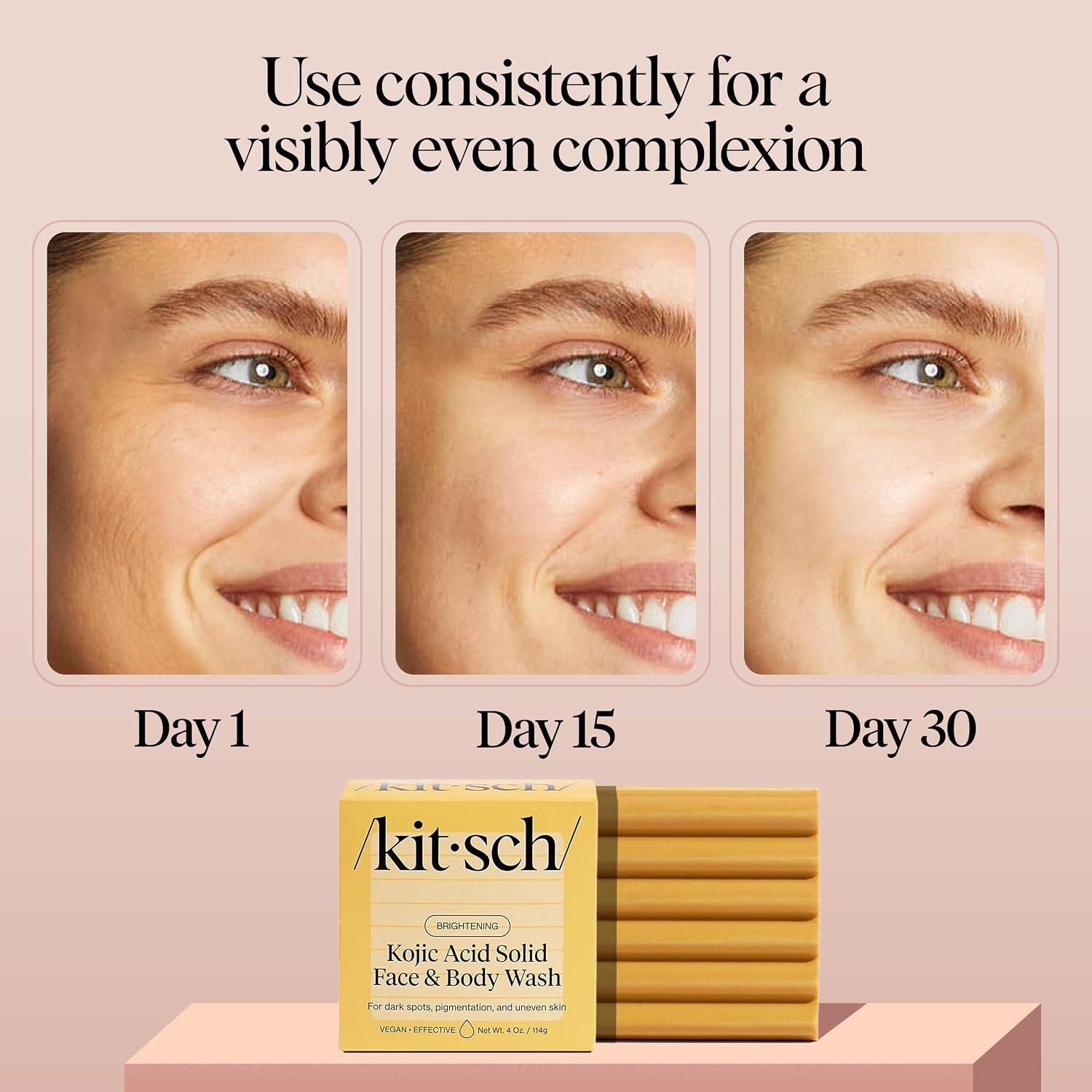 Kitsch Kojic Acid Soap – Turmeric Soap Bar With Hyaluronic Acid & Shea Butter – Brightening & Hydrating Body Wash & Face Wash For Dark Spots, Even Skin Tone & Natural Glow - Made In Usa - 4 Oz