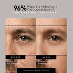 Brickell Men'S Restoring Under Eye Cream For Men, Anti Aging Eye Balm To Reduce Puffiness, Wrinkles, Dark Circles, Crows Feet & Eye Bags, Caffeine, Hyaluronic Acid & Protein Peptides, 0.5Oz, Unscented