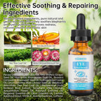 Eye Serum For Chalazion & Blepharitis, 30Ml Chalazion Remover For Eyelid, Blepharitis Eyelid Serum With Avocado Oil, Sea Buckthorn Oil & Caffeine, Relieve Puffiness And Eye Fatigue