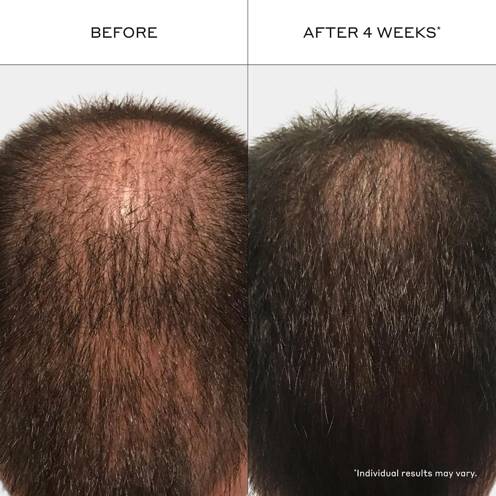 Zenagen Revolve Men'S Thickening Shampoo | Supports Appearance Of Fuller, Healthier-Looking Hair, Developed For Fine & Visibly Thinning Hair, Plant-Based, Color-Safe, 5-Minute Treatment
