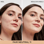 IT Cosmetics Bye Bye Dark Spots Concealer + Brightening Serum – 2% Niacinamide, Hyaluronic Acid & Caffeine - Medium Coverage, Natural Finish, All Skin Types - 0.22 fl oz