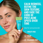 Good Molecules 10% Azelaic Acid Treatment for Face – Soothing Formula for Facial Redness & Uneven Tone – Brightens Dark Spots & Refines Texture – Vegan & Fragrance-Free Skincare (30ml / 1.01 fl oz.)