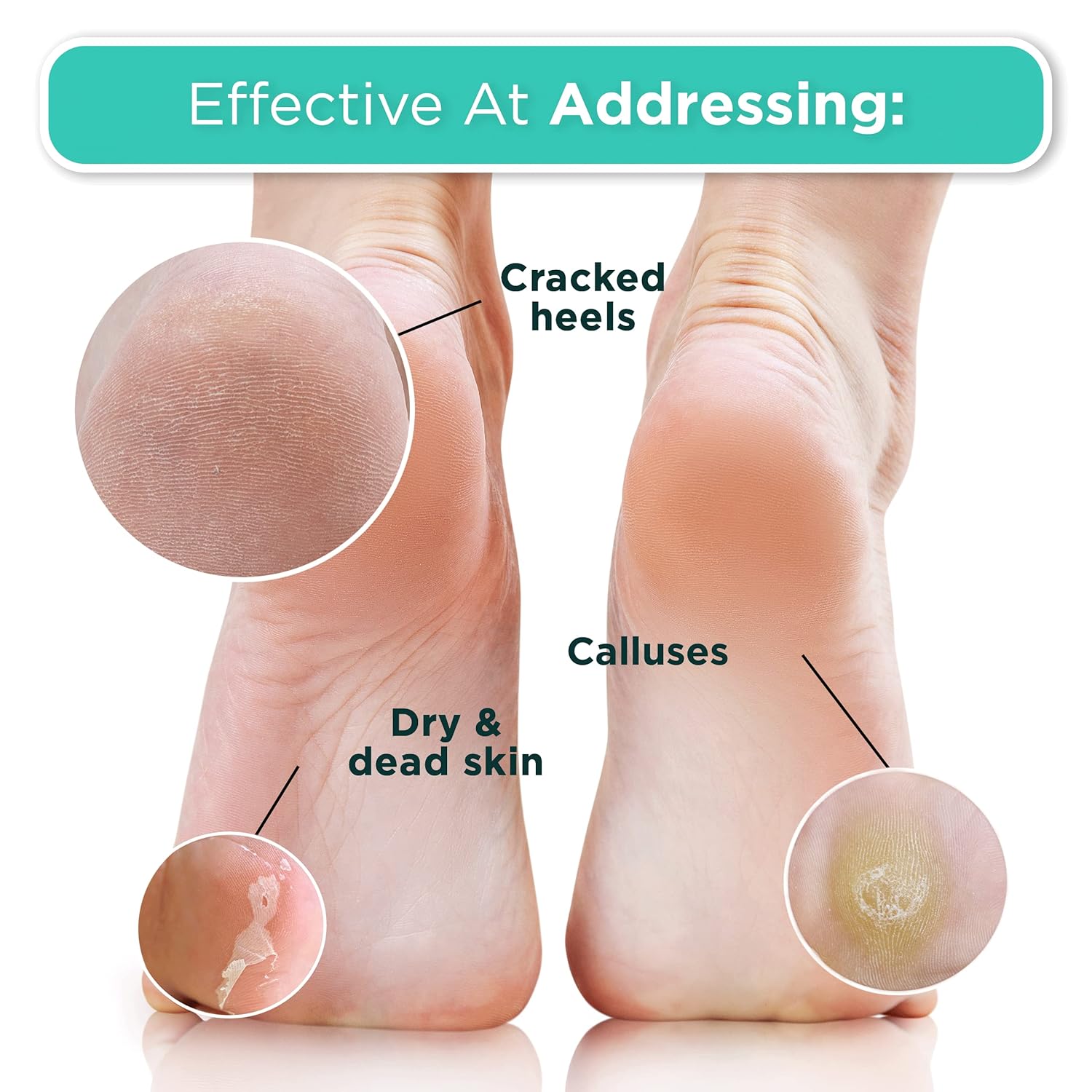 DERMORA Foot Peel Mask | Skin Exfoliating Foot Masks for Dry, Cracked Feet & Callus Removal | Dead Skin Exfoliator for Baby Soft Feet | Pack of 2 | Regular (Fits up to Men 10 / Women 11) | Original