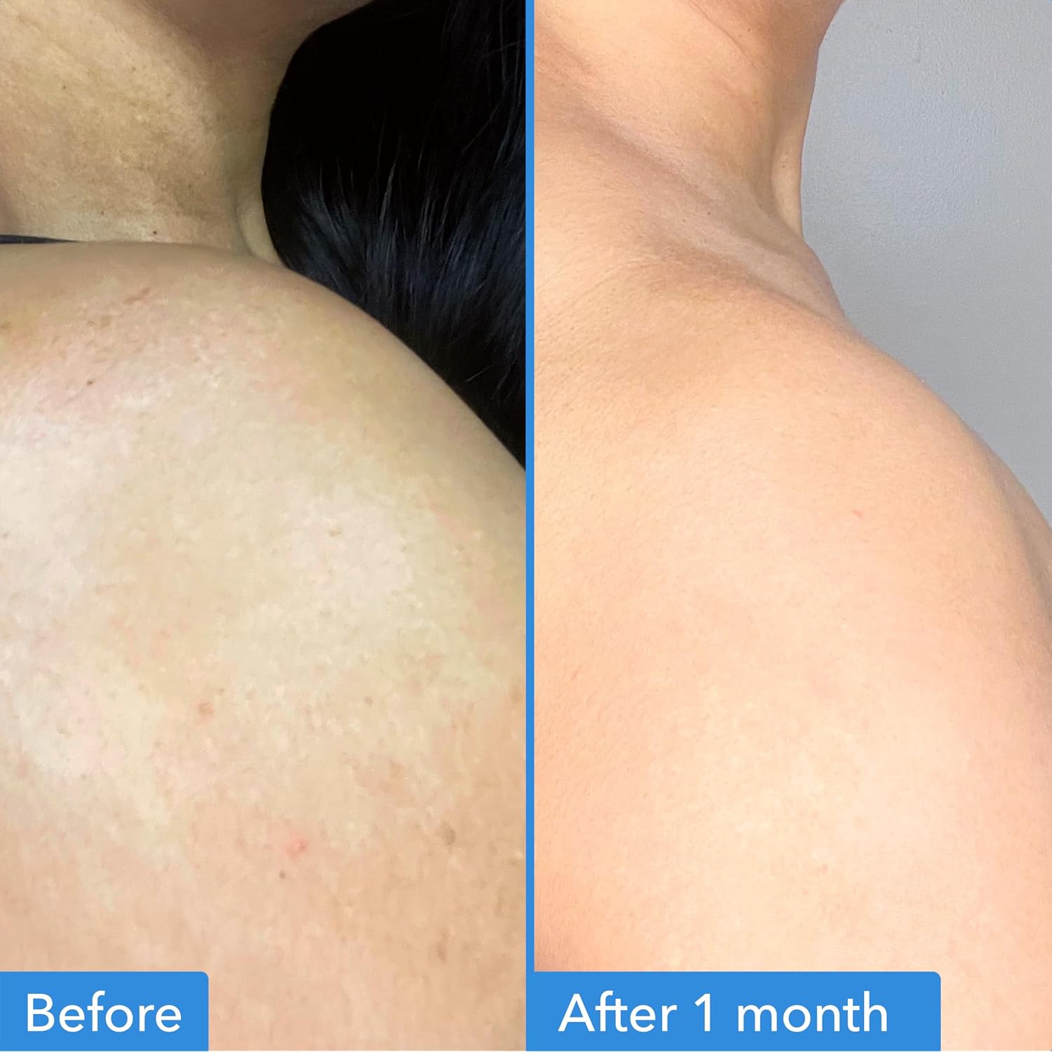 Good Molecules Discoloration Correcting Body Treatment - Anti-Pigment Cream With Niacinamide, Tranexamic Acid - Target Dark Spots And Moisturize - Skincare For Body