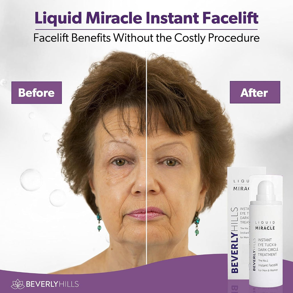 Beverly Hills Instant Facelift Anti Aging Eye Serum Treatment For Dark Circles, Puffy Eyes, Wrinkles, Under Eye Bags, Fine Lines, And Crows Feet | 30Ml (120 Days Supply)