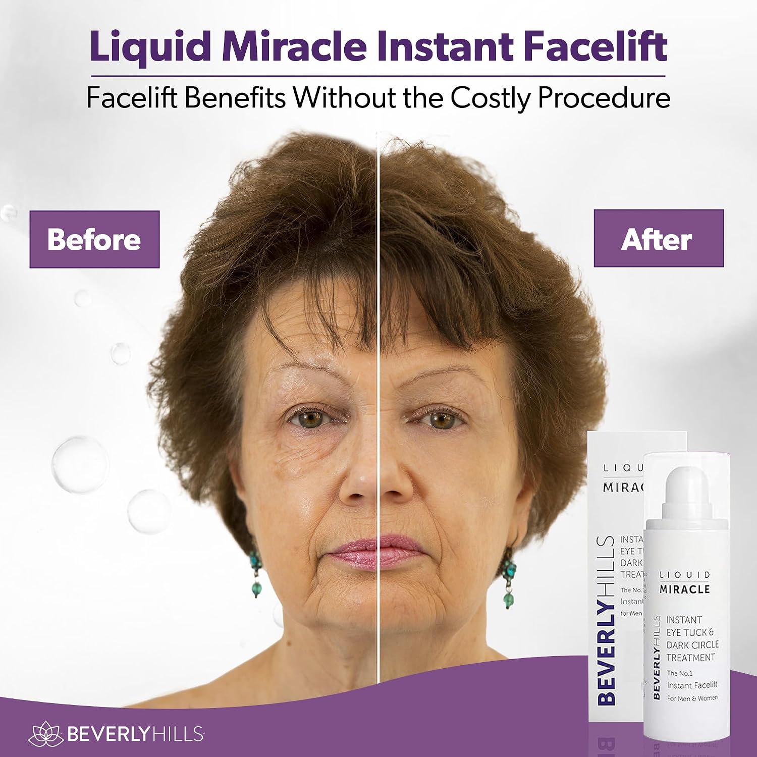 Beverly Hills Instant Facelift Anti Aging Eye Serum Treatment For Dark Circles, Puffy Eyes, Wrinkles, Under Eye Bags, Fine Lines, And Crows Feet | 30Ml (120 Days Supply)