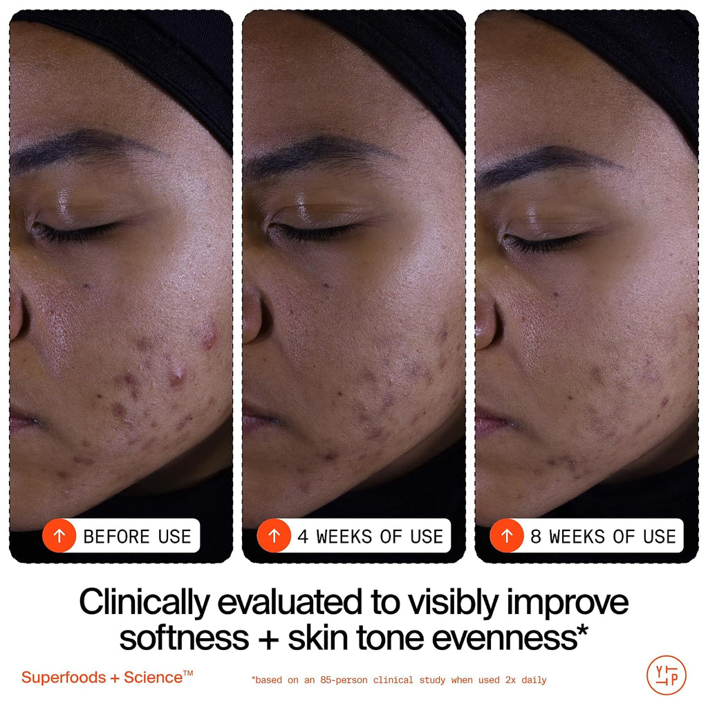 Youth To The People Superfruit Facial Cleanser - Papaya + Vitamin C Gentle Exfoliating Face Wash, Cellular Skin Renewal With Aha + Bha, Evens Skin Tone & Texture For Soft + Radiant Skin, Sulfate-Free