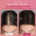 5% Minoxidil Foam For Women Hair Growth: Extra Strength Hair Regrowth Treatment – Revitalize Hair Follicles & Regrow Thicker, Fuller Hair – Hair Loss Solution 2Pcs