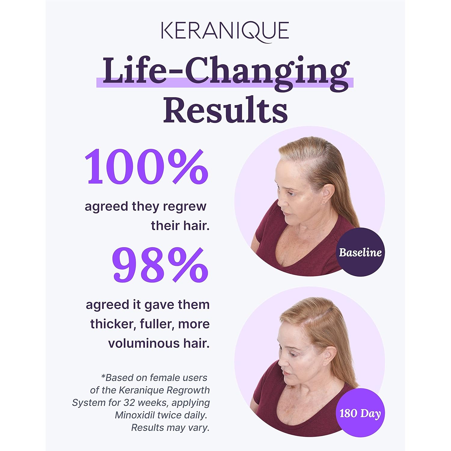 Keranique Hair Regrowth Treatment for Women - 2% Minoxidil for Hair Growth & Thickening - Topical Solution Scalp Treatment for Hair Loss & Thinning w/ Precision Spray Applicator - 2 Fl Oz