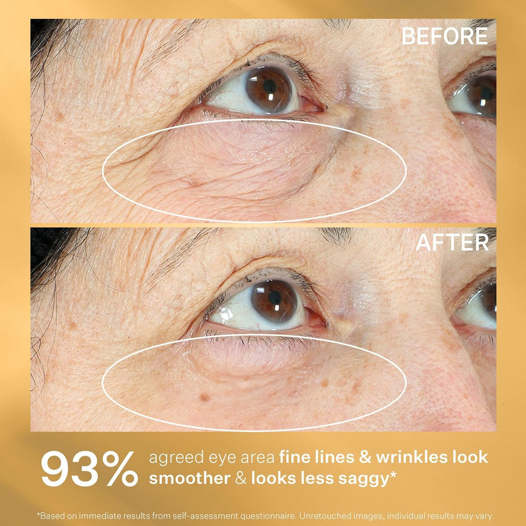 Strivectin Eye Cream Treatment, Firm, Tighten & Lift Eye Area For Bags