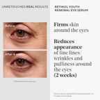 Murad Retinol Youth Renewal Eye Serum - Retinol Eye Serum Visibly Improves Undereye Puffiness Dark Circles And Reduces The Appearance Of Fine Lines, Gentle Enough For Nightly Use - 0.5 Oz