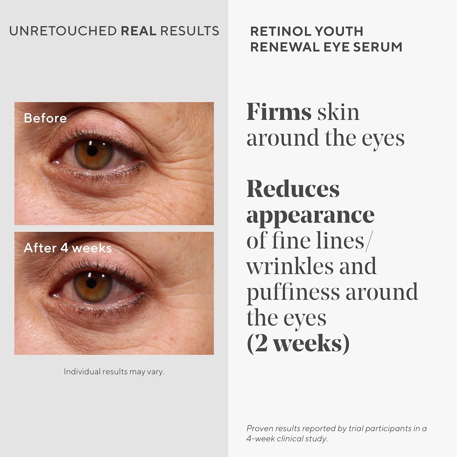 Murad Retinol Youth Renewal Eye Serum - Retinol Eye Serum Visibly Improves Undereye Puffiness Dark Circles And Reduces The Appearance Of Fine Lines, Gentle Enough For Nightly Use - 0.5 Oz