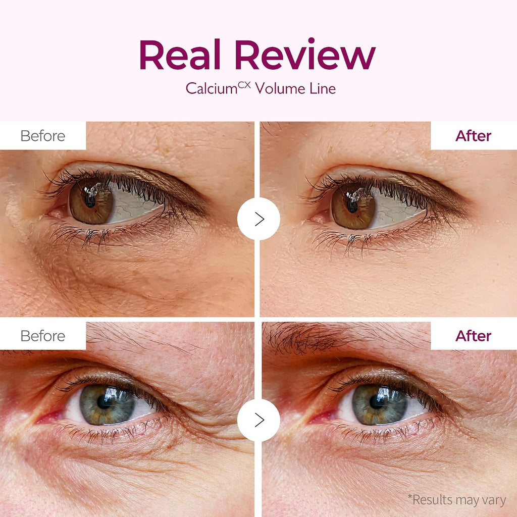 Dr.Melaxin Calcium Volume Under Eye Patches For Puffy Eyes & Dark Circles, Hydrogel Eye Mask For Wrinkles, Fine Lines & Sagging Skin, Firming Collagen Eye Patch, Korean Skin Care (60 Count)