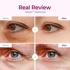 Dr.Melaxin Calcium Volume Under Eye Patches For Puffy Eyes & Dark Circles, Hydrogel Eye Mask For Wrinkles, Fine Lines & Sagging Skin, Firming Collagen Eye Patch, Korean Skin Care (60 Count)